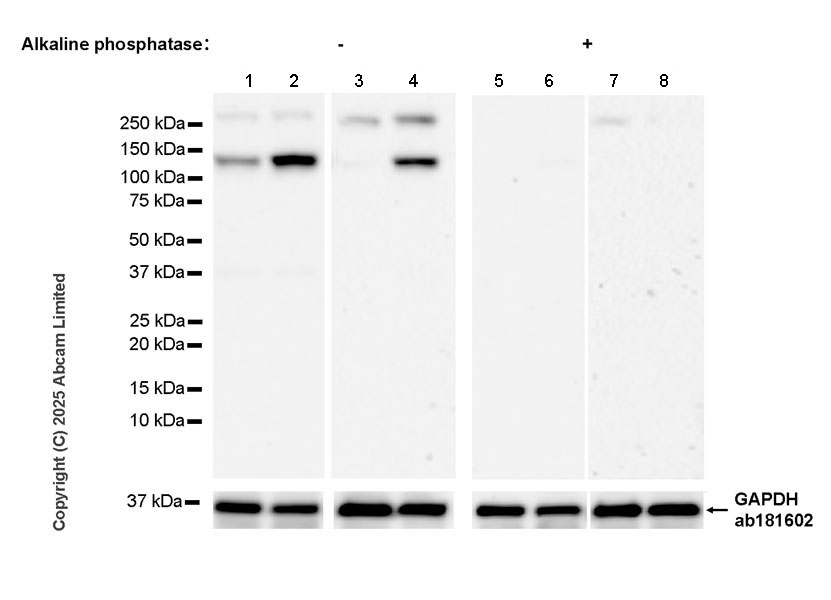 Western blot - Anti-IRE1 (phospho S724) antibody [EPR26009-269] (ab324051), expandable thumbnail