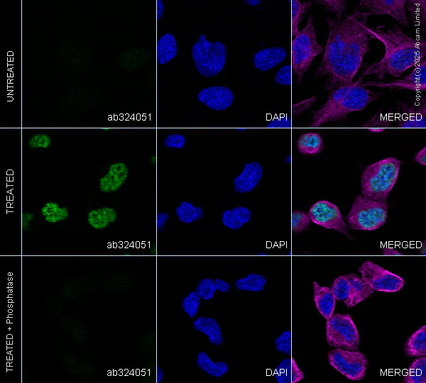Immunocytochemistry/ Immunofluorescence - Anti-IRE1 (phospho S724) antibody [EPR26009-269] - BSA and Azide free (AB326602)