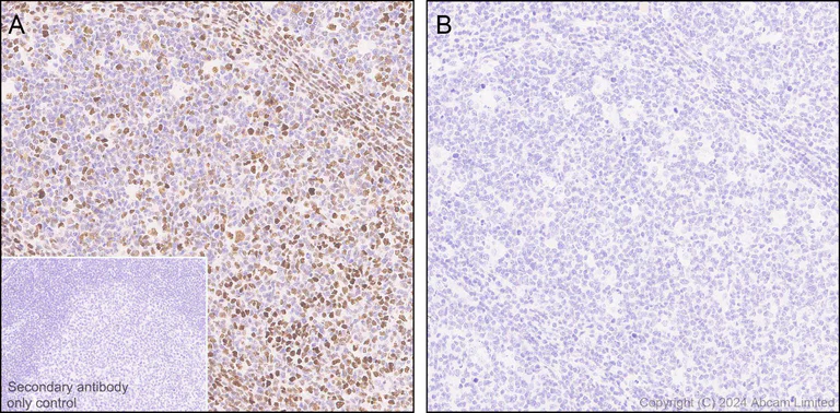 Immunohistochemistry (Formalin/PFA-fixed paraffin-embedded sections) - Anti-IRE1 (phospho S724) antibody [EPR26009-269] - BSA and Azide free (AB326602)