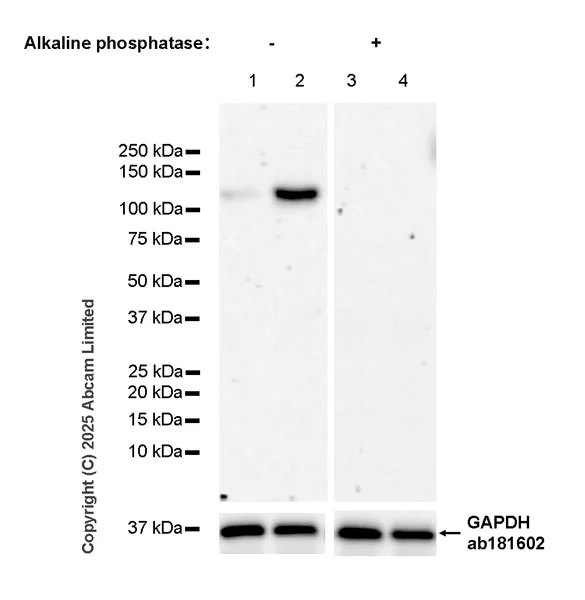 Western blot - Anti-IRE1 (phospho S724) antibody [EPR26009-269] - BSA and Azide free (AB326602)