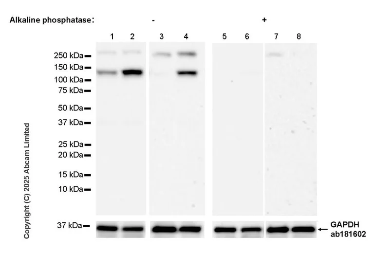 Western blot - Anti-IRE1 (phospho S724) antibody [EPR26009-269] - BSA and Azide free (AB326602)