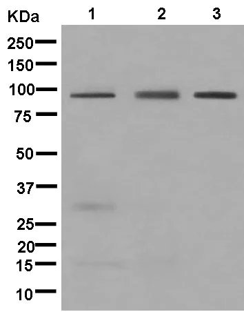 Western blot - Anti-IREB2/IRP2 + Aconitase 1/ACO1 antibody [EPR13854] (AB181153)