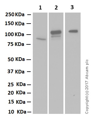 Western blot - Anti-IREB2/IRP2 + Aconitase 1/ACO1 antibody [EPR13854] (AB181153), expandable thumbnail