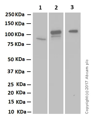 Western blot - Anti-IREB2/IRP2 + Aconitase 1/ACO1 antibody [EPR13854] (AB181153)
