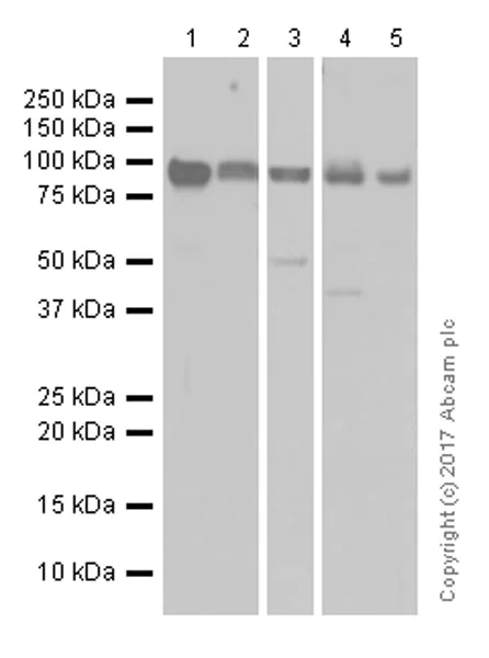 Western blot - Anti-IREB2/IRP2 + Aconitase 1/ACO1 antibody [EPR13854] (AB181153)