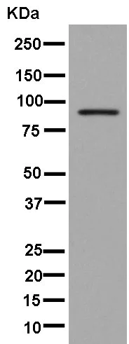 Western blot - Anti-IREB2/IRP2 + Aconitase 1/ACO1 antibody [EPR13854] (AB181153)