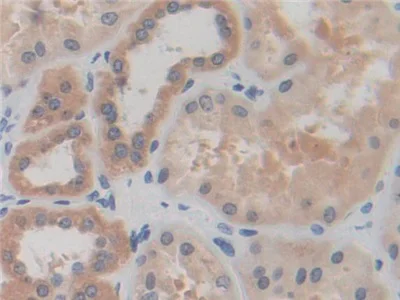 Immunohistochemistry (Formalin/PFA-fixed paraffin-embedded sections) - Anti-IREB2/IRP2 antibody (AB232994)