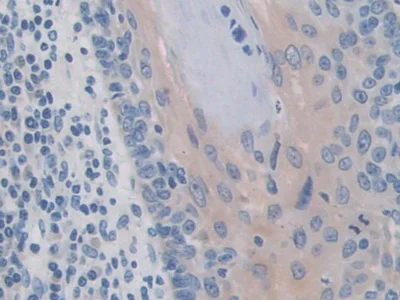 Immunohistochemistry (Formalin/PFA-fixed paraffin-embedded sections) - Anti-IREB2/IRP2 antibody (AB232994)