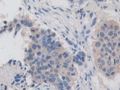 Immunohistochemistry (Formalin/PFA-fixed paraffin-embedded sections) - Anti-IREB2/IRP2 antibody (AB232994)