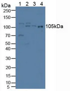 Western blot - Anti-IREB2/IRP2 antibody (AB232994)