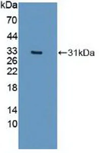 Western blot - Anti-IREB2/IRP2 antibody (AB232994)