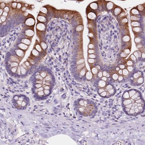 Immunohistochemistry (Formalin/PFA-fixed paraffin-embedded sections) - Anti-IREB2/IRP2 antibody (AB244539)
