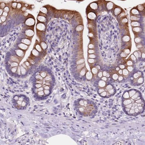 Immunohistochemistry (Formalin/PFA-fixed paraffin-embedded sections) - Anti-IREB2/IRP2 antibody (AB244539)