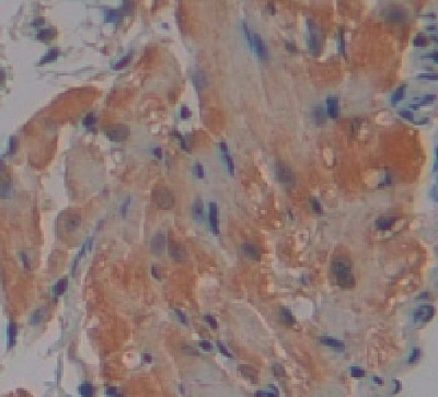 Immunohistochemistry (Formalin/PFA-fixed paraffin-embedded sections) - Anti-IRF1 antibody (AB232861), expandable thumbnail