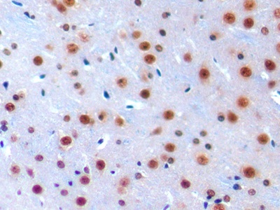 Immunohistochemistry (Formalin/PFA-fixed paraffin-embedded sections) - Anti-IRF1 antibody (ab232861), expandable thumbnail