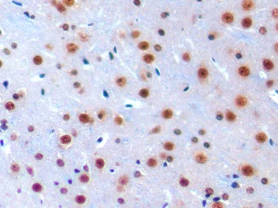 Immunohistochemistry (Formalin/PFA-fixed paraffin-embedded sections) - Anti-IRF1 antibody (AB232861)