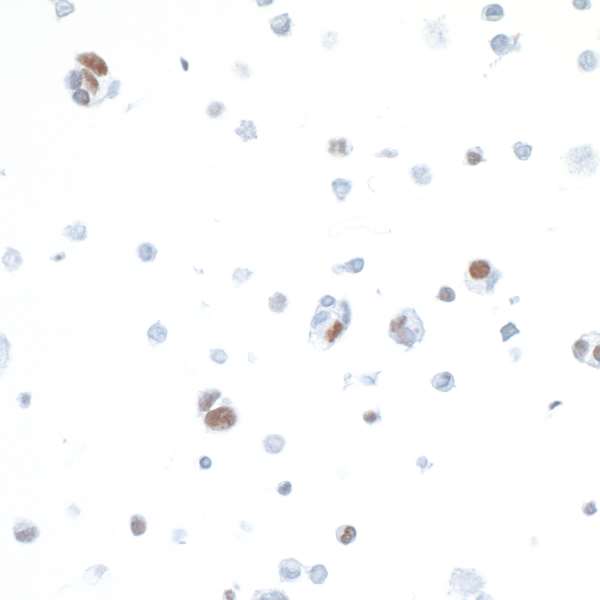 Immunocytochemistry - Anti-IRF1 antibody [BLR039F] (AB243895)