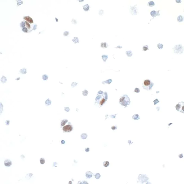 Immunocytochemistry - Anti-IRF1 antibody [BLR039F] - BSA free (AB272088)