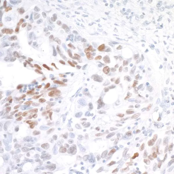 Immunohistochemistry (Formalin/PFA-fixed paraffin-embedded sections) - Anti-IRF1 antibody [BLR039F] - BSA free (AB272088)