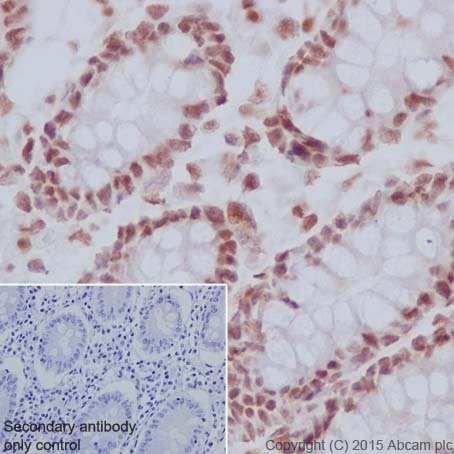 Immunohistochemistry (Formalin/PFA-fixed paraffin-embedded sections) - Anti-IRF2 antibody [EPR4644(2)] (AB124744), expandable thumbnail