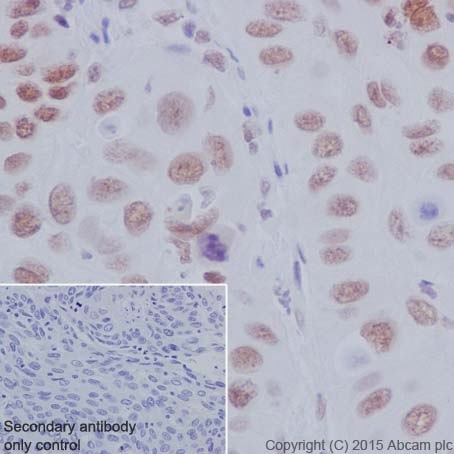 Immunohistochemistry (Formalin/PFA-fixed paraffin-embedded sections) - Anti-IRF2 antibody [EPR4644(2)] (ab124744), expandable thumbnail
