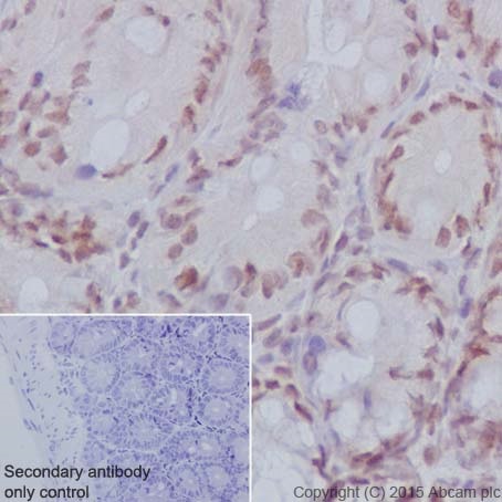 Immunohistochemistry (Formalin/PFA-fixed paraffin-embedded sections) - Anti-IRF2 antibody [EPR4644(2)] (ab124744), expandable thumbnail