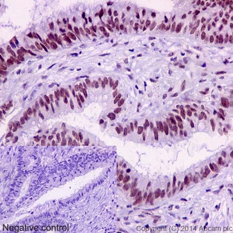 Immunohistochemistry (Formalin/PFA-fixed paraffin-embedded sections) - Anti-IRF2 antibody [EPR4644(2)] (ab124744), expandable thumbnail