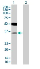Western blot - IRF2 overexpression 293T lysate (whole cell) (AB94267)