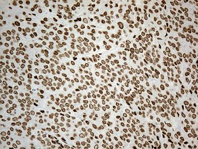 Immunohistochemistry (Formalin/PFA-fixed paraffin-embedded sections) - Anti-IRF2BP1 antibody [OTI3A6] (AB236392)