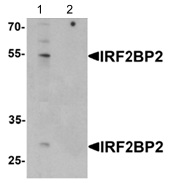 Western blot - Anti-IRF2BP2 antibody (AB124163)