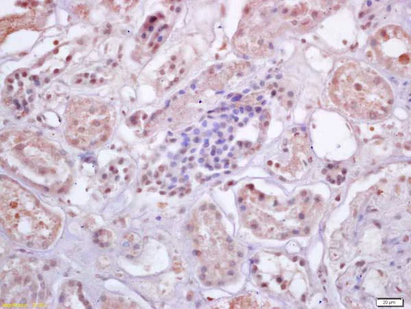 Immunohistochemistry (Formalin/PFA-fixed paraffin-embedded sections) - Anti-IRF3 antibody (AB218160)