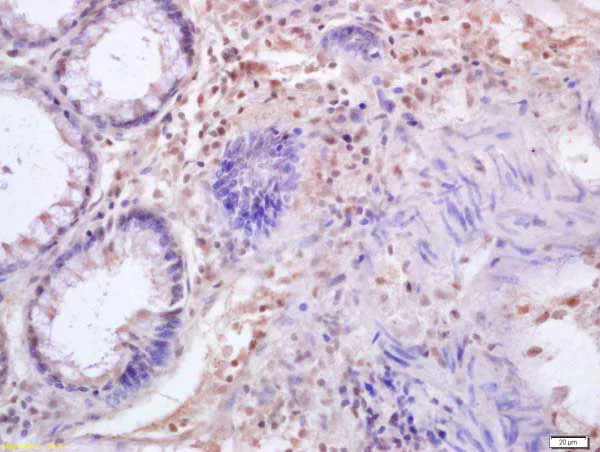 Immunohistochemistry (Formalin/PFA-fixed paraffin-embedded sections) - Anti-IRF3 antibody (AB218160)