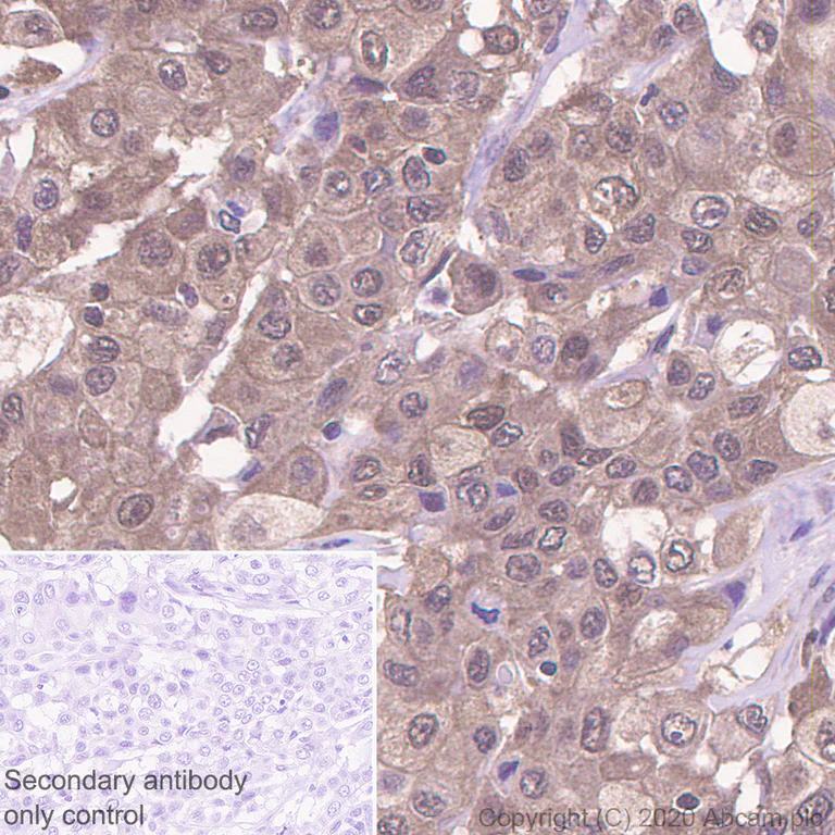 Immunohistochemistry (Formalin/PFA-fixed paraffin-embedded sections) - Anti-IRF3 antibody [EP2419Y] (AB76409)