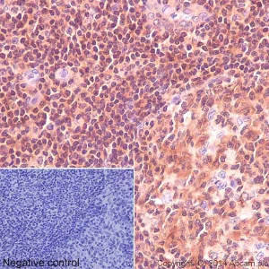 Immunohistochemistry (Formalin/PFA-fixed paraffin-embedded sections) - Anti-IRF3 antibody [EPR2418Y] (AB68481)