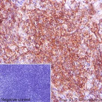 Immunohistochemistry (Formalin/PFA-fixed paraffin-embedded sections) - Anti-IRF3 antibody [EPR2418Y] - BSA and Azide free (AB201809)