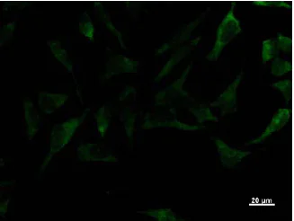 Immunocytochemistry/ Immunofluorescence - Anti-IRF3 antibody [IRF35I218] (AB50772)