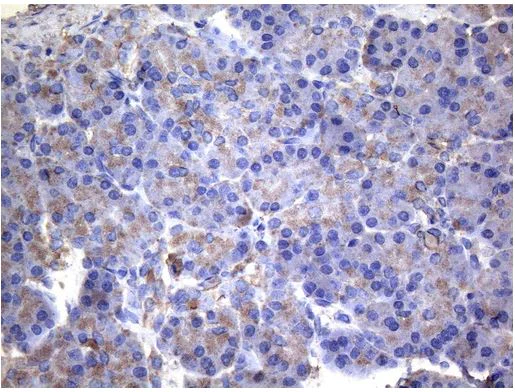 Immunohistochemistry (Formalin/PFA-fixed paraffin-embedded sections) - Anti-IRF3 antibody [OTI4A1] - BSA and Azide free (AB273663)