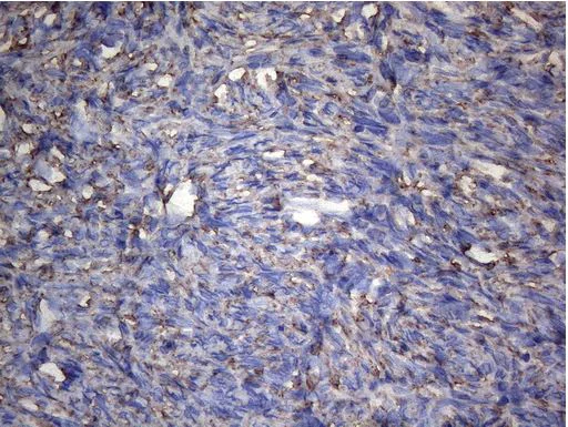 Immunohistochemistry (Formalin/PFA-fixed paraffin-embedded sections) - Anti-IRF3 antibody [OTI4A1] - BSA and Azide free (AB273663)