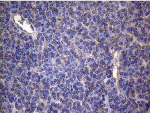 Immunohistochemistry (Formalin/PFA-fixed paraffin-embedded sections) - Anti-IRF3 antibody [OTI4A1] - BSA and Azide free (AB273663)
