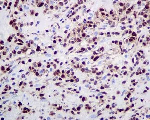 Immunohistochemistry (Formalin/PFA-fixed paraffin-embedded sections) - Anti-IRF4 antibody [EP5699] - BSA and Azide free (AB240071)