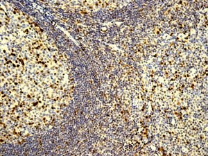Immunohistochemistry (Formalin/PFA-fixed paraffin-embedded sections) - Anti-IRF4 antibody [EP5699] - BSA and Azide free (AB240071), expandable thumbnail