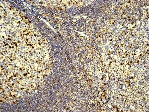 Immunohistochemistry (Formalin/PFA-fixed paraffin-embedded sections) - Anti-IRF4 antibody [EP5699] - BSA and Azide free (AB240071)