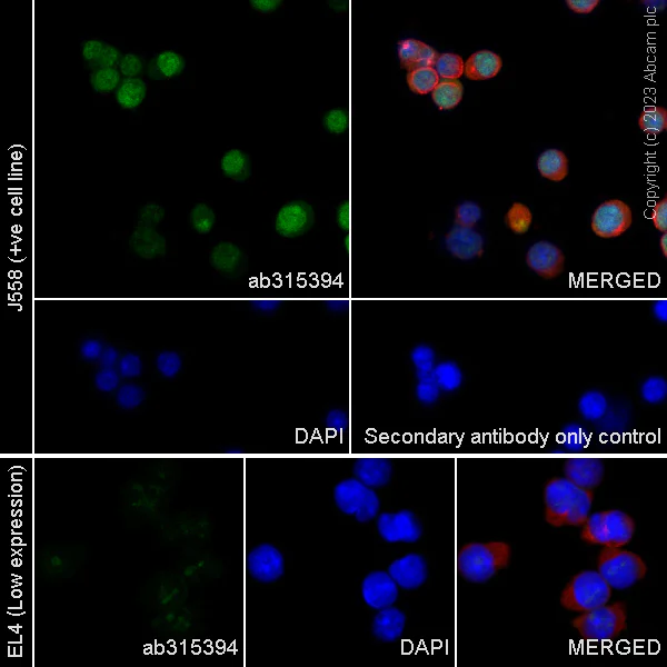 Immunocytochemistry/ Immunofluorescence - Anti-IRF4 antibody [EPR28687-87] (AB315394)