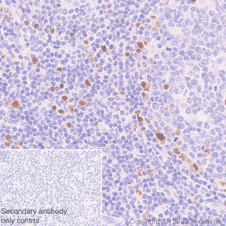 Immunohistochemistry (Formalin/PFA-fixed paraffin-embedded sections) - Anti-IRF4 antibody [EPR28687-87] - BSA and Azide free (AB315395)