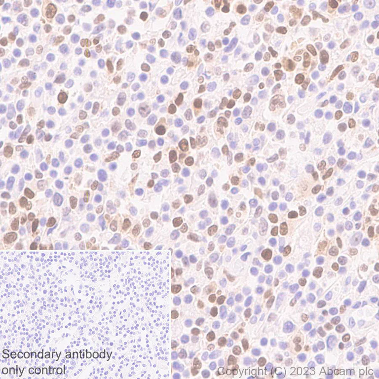 Immunohistochemistry (Formalin/PFA-fixed paraffin-embedded sections) - Anti-IRF4 antibody [EPR28687-87] - BSA and Azide free (AB315395)