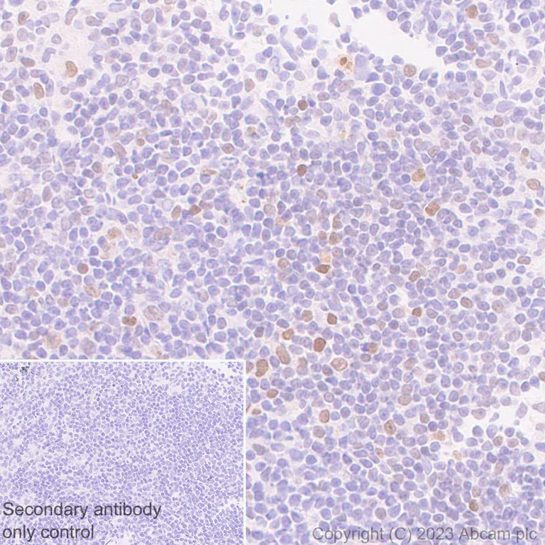Immunohistochemistry (Formalin/PFA-fixed paraffin-embedded sections) - Anti-IRF4 antibody [EPR28687-87] - BSA and Azide free (AB315395)