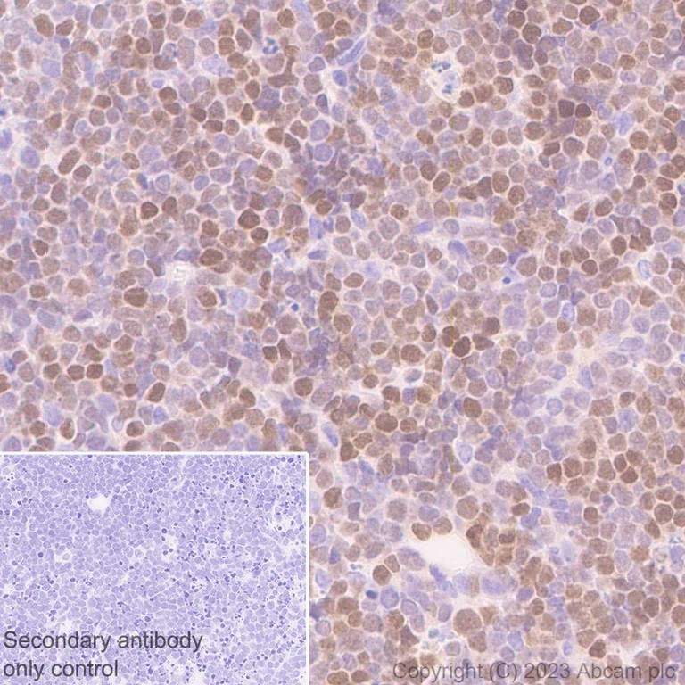 Immunohistochemistry (Formalin/PFA-fixed paraffin-embedded sections) - Anti-IRF4 antibody [EPR28687-87] - BSA and Azide free (AB315395)