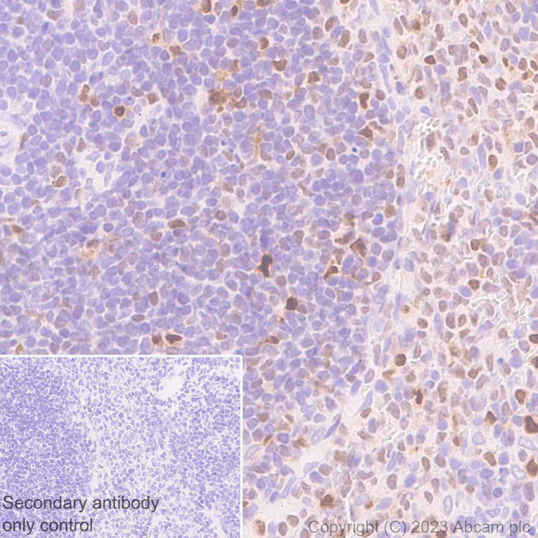 Immunohistochemistry (Formalin/PFA-fixed paraffin-embedded sections) - Anti-IRF4 antibody [EPR28687-87] - BSA and Azide free (AB315395)
