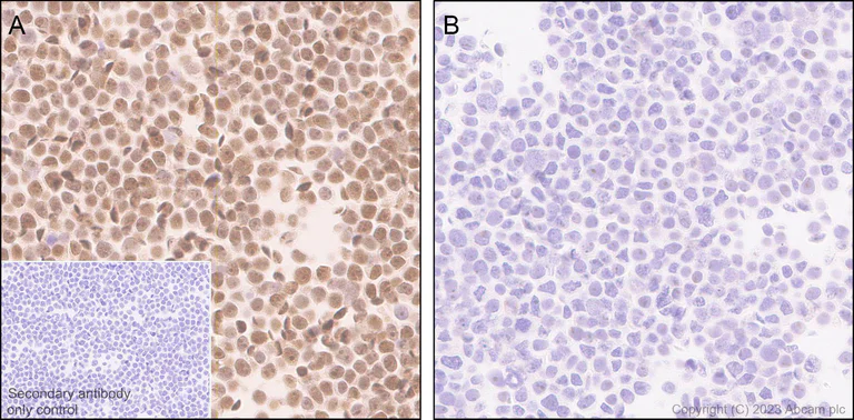 Immunohistochemistry (Formalin/PFA-fixed paraffin-embedded sections) - Anti-IRF4 antibody [EPR28687-87] - BSA and Azide free (AB315395)