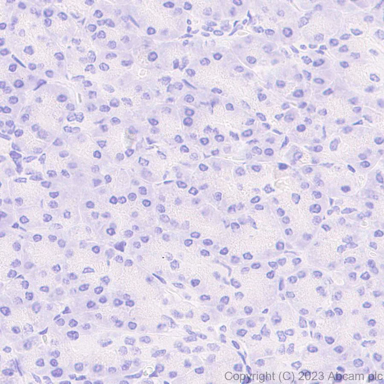 Immunohistochemistry (Formalin/PFA-fixed paraffin-embedded sections) - Anti-IRF4 antibody [EPR28687-87] - BSA and Azide free (AB315395)